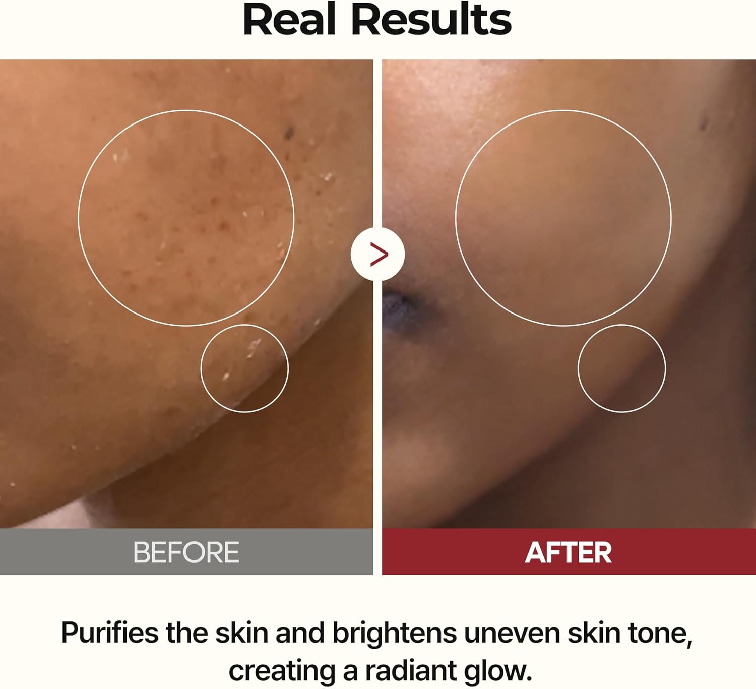 Dr.Melaxin Peel Shot Glow Rice Toner 200ml hydrated Skin Cleansing Skin Korean Skin Care